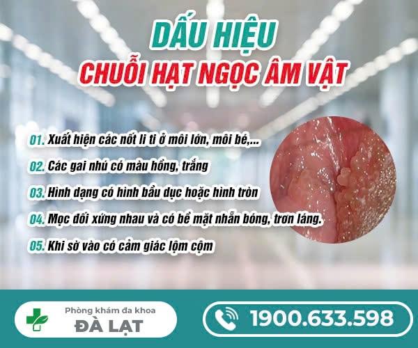 Hình ảnh minh họa
